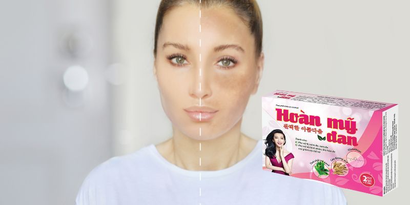 Cách trị nám da mặt nhanh nhất với Hoàn Mỹ Đan