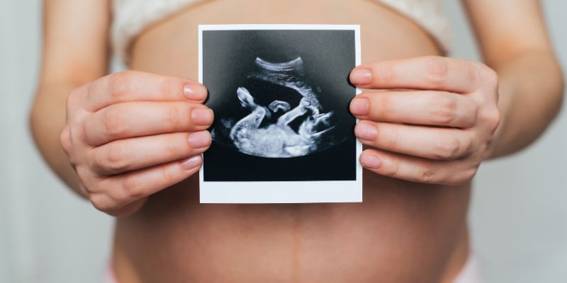 Bụng bầu ở 14 tuần của thai kỳ