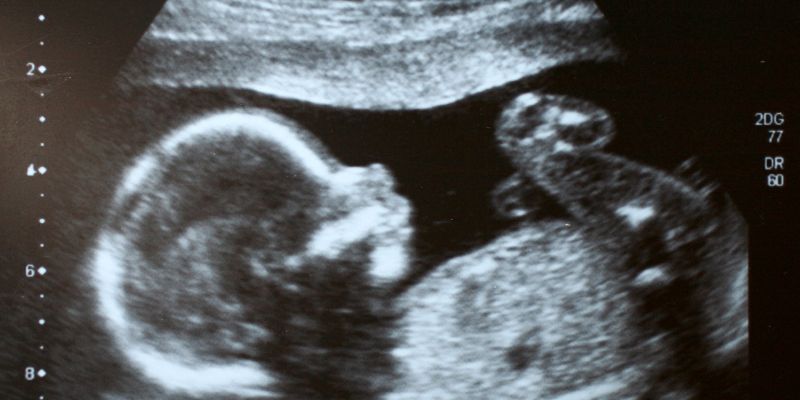 mang-thai-27-tuan-dieu-gi-se-xay-ra-voi-me-va-be