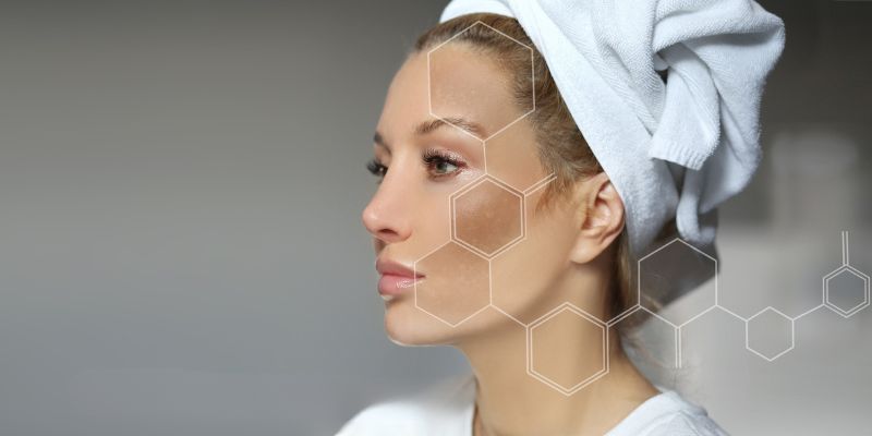 Nám da mặt vùng má: Giải mã nguyên nhân và cách chữa trị