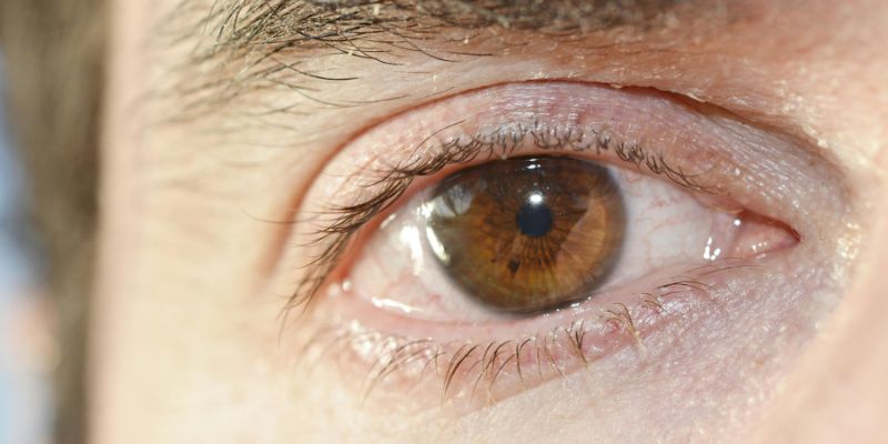 Lời giải nháy mắt trái ở Nữ theo luận điểm tâm linh