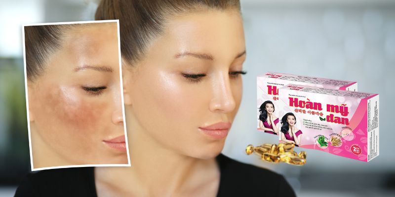 review-hoan-my-dan-co-tot-khong-co-hieu-qua-trong-tri-mun-nam