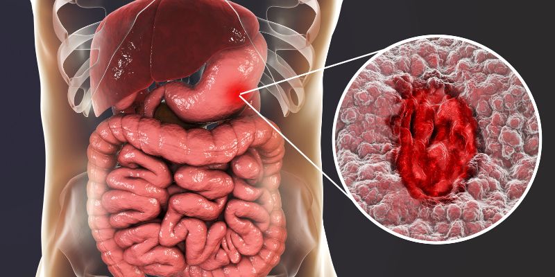 Vậy Thuốc Omsergy có tác dụng gì?